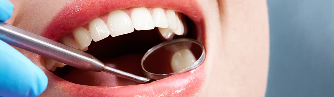 Dental Sealants in Orange City FL