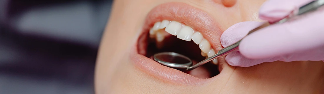 Oral Cancer Screening in Orange City FL