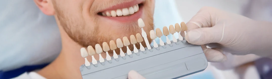 Porcelain Dental Veneers in Orange City FL