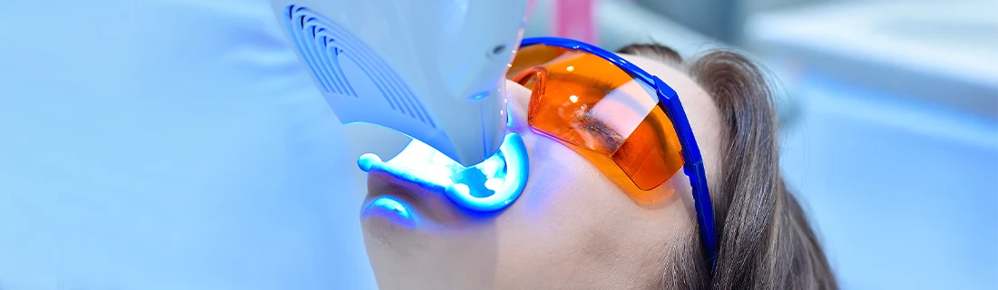 Professional Teeth Whitening in Orange City FL